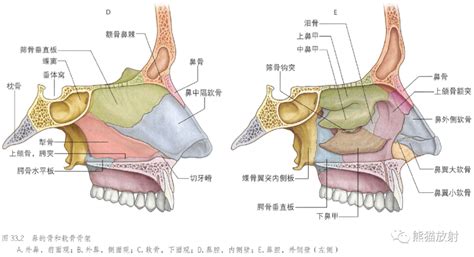 鼻子部位|鼻和鼻旁窦附标记解剖插图